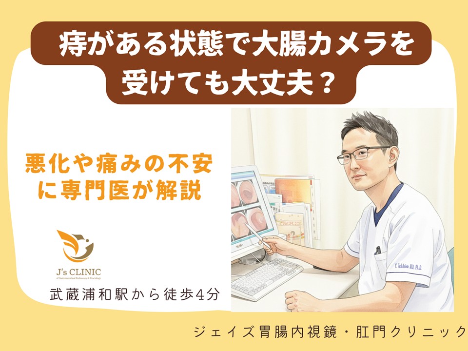 専門医が痔と大腸カメラについて解説