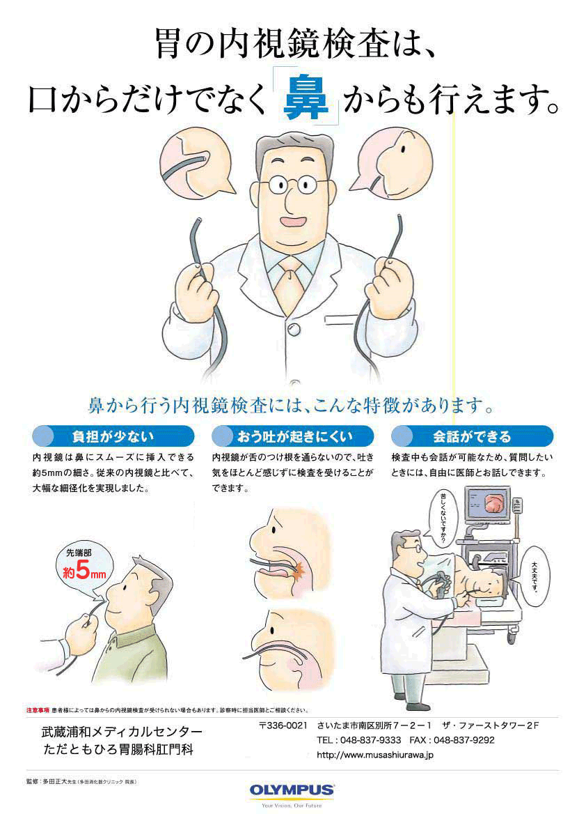 胃の内視鏡検査