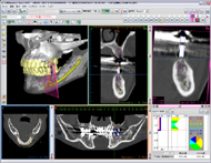 歯科用CT完備（1）
